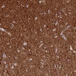 CK068 Antibody in Immunohistochemistry (Paraffin) (IHC (P))