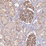 CK068 Antibody in Immunohistochemistry (Paraffin) (IHC (P))