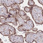 CK068 Antibody in Immunohistochemistry (Paraffin) (IHC (P))