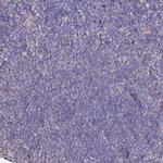 CK068 Antibody in Immunohistochemistry (Paraffin) (IHC (P))