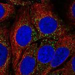 CAB39L Polyclonal Antibody