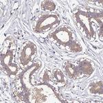 CAB39L Antibody in Immunohistochemistry (Paraffin) (IHC (P))