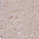 CAB39L Antibody in Immunohistochemistry (Paraffin) (IHC (P))