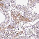CAB39L Antibody in Immunohistochemistry (Paraffin) (IHC (P))