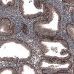 ZDHHC14 Polyclonal Antibody