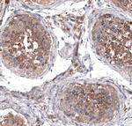 ZDHHC14 Antibody in Immunohistochemistry (IHC)