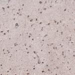 ZDHHC14 Antibody in Immunohistochemistry (IHC)