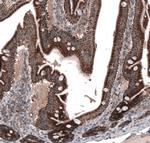 ZDHHC14 Antibody in Immunohistochemistry (IHC)