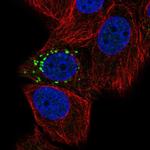 PPM1J Polyclonal Antibody