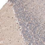 PPM1J Antibody in Immunohistochemistry (Paraffin) (IHC (P))