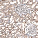 PPM1J Antibody in Immunohistochemistry (Paraffin) (IHC (P))