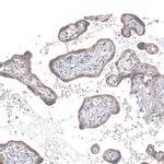PPM1J Antibody in Immunohistochemistry (Paraffin) (IHC (P))