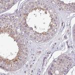 PPM1J Antibody in Immunohistochemistry (IHC)