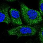 COQ10B Polyclonal Antibody