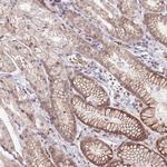 TM2D1 Antibody in Immunohistochemistry (Paraffin) (IHC (P))