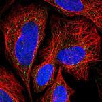 TLCD2 Polyclonal Antibody