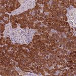 TLCD2 Antibody in Immunohistochemistry (Paraffin) (IHC (P))