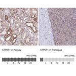 ATP Synthase B1 Antibody in Immunohistochemistry (IHC)