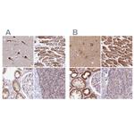 ATP Synthase B1 Antibody in Immunohistochemistry (IHC)