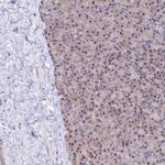 ATP Synthase B1 Antibody in Immunohistochemistry (IHC)