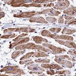 ATP Synthase B1 Antibody in Immunohistochemistry (IHC)