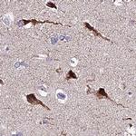 ATP Synthase B1 Antibody in Immunohistochemistry (IHC)