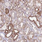 ATP Synthase B1 Polyclonal Antibody