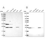 ATP Synthase B1 Antibody in Western Blot (WB)