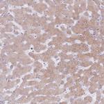 CRIPT Antibody in Immunohistochemistry (IHC)