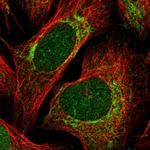 hnRNP LL Polyclonal Antibody