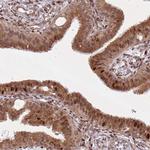 hnRNP LL Antibody in Immunohistochemistry (IHC)