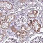 SPCS1 Antibody in Immunohistochemistry (IHC)