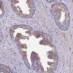 SPCS1 Antibody in Immunohistochemistry (IHC)
