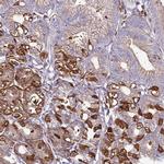 SPCS1 Antibody in Immunohistochemistry (IHC)