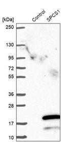 SPCS1 Antibody in Western Blot (WB)