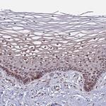 POLR2D Polyclonal Antibody