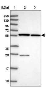 ZNF285 Antibody in Western Blot (WB)