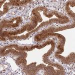 PEX14 Antibody in Immunohistochemistry (Paraffin) (IHC (P))