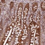 PEX14 Antibody in Immunohistochemistry (Paraffin) (IHC (P))