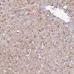 PEX14 Antibody in Immunohistochemistry (Paraffin) (IHC (P))