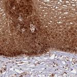 PEX14 Antibody in Immunohistochemistry (IHC)