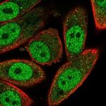 RNF181 Polyclonal Antibody