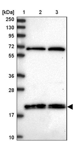 RNF181 Antibody in Western Blot (WB)