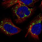 APC13 Polyclonal Antibody