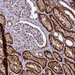 APC13 Antibody in Immunohistochemistry (IHC)