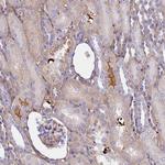 CRHBP Polyclonal Antibody