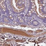 CRHBP Antibody in Immunohistochemistry (Paraffin) (IHC (P))
