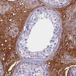 CRHBP Antibody in Immunohistochemistry (Paraffin) (IHC (P))