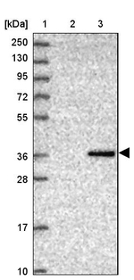CRHBP Antibody in Western Blot (WB)