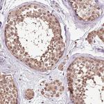 BBS5 Polyclonal Antibody